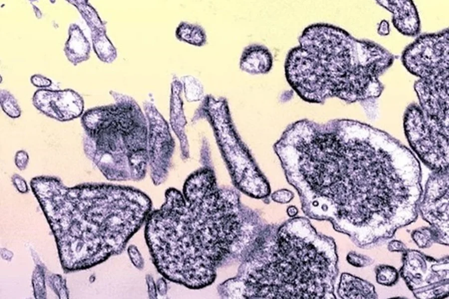 Índia confirma surto do vírus Nipah, e fica em alerta; Mais de 100 estão em quarentena.