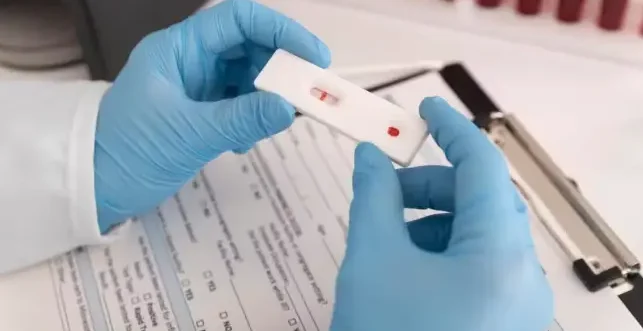 Dois novos casos de cura do HIV são anunciados e total chega a 13